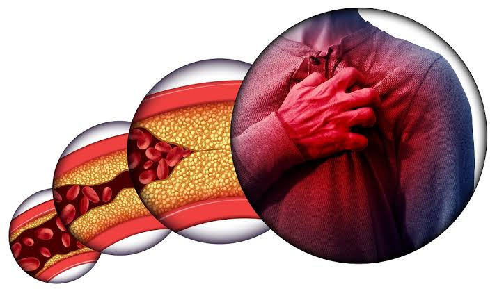 Kötü kolesterol nedir? Kolesterol değerleri yüksek-düşük ve normal kaç olur  - Sağlık Haberleri
