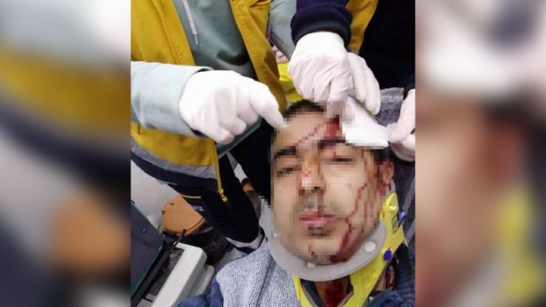 İMAM MÜEZZİNE TABUREYLE SALDIRDI