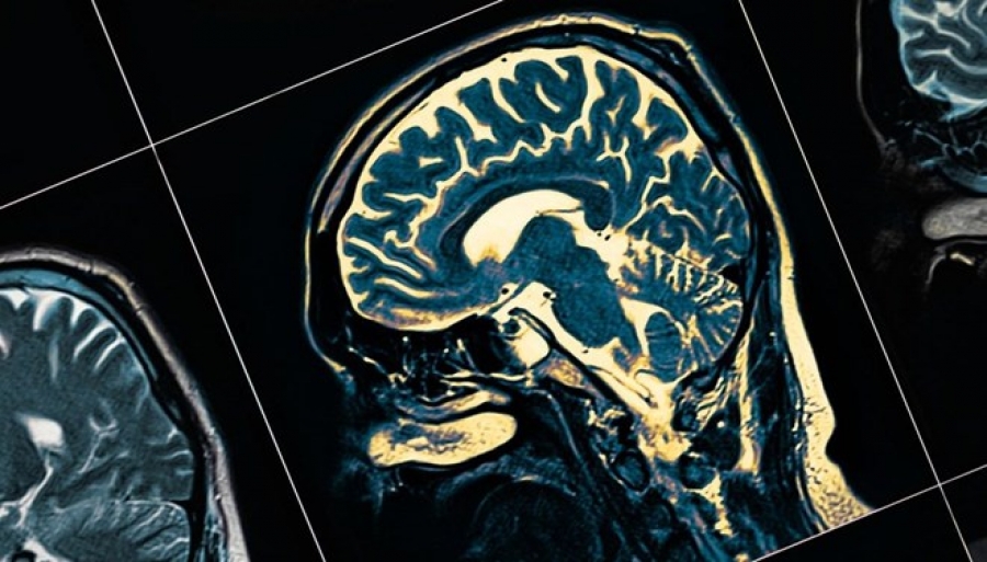 Bilim Alzheimer’ı Unutmamış!