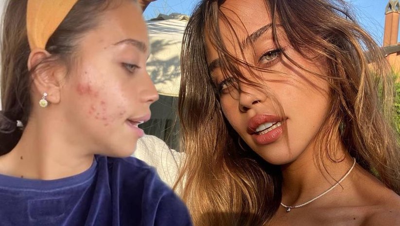 ZEYNEP ALKAN: ÖZGÜVENİM SIFIR, DIŞARI BİLE ÇIKMAK İSTEMİYORUM