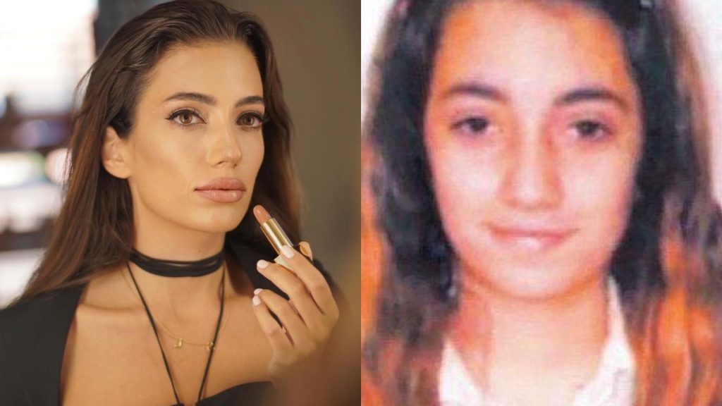 Rachel Araz ‘Estetik’ İddialarına Cevap Verdi!