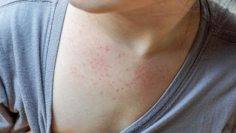 Uzmanından Domates Virüsüne Karşı Uyarı!