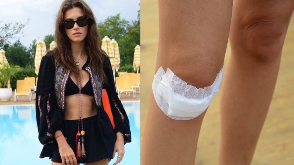 Yüsra Geyik: Dizlerim Parçalandı!